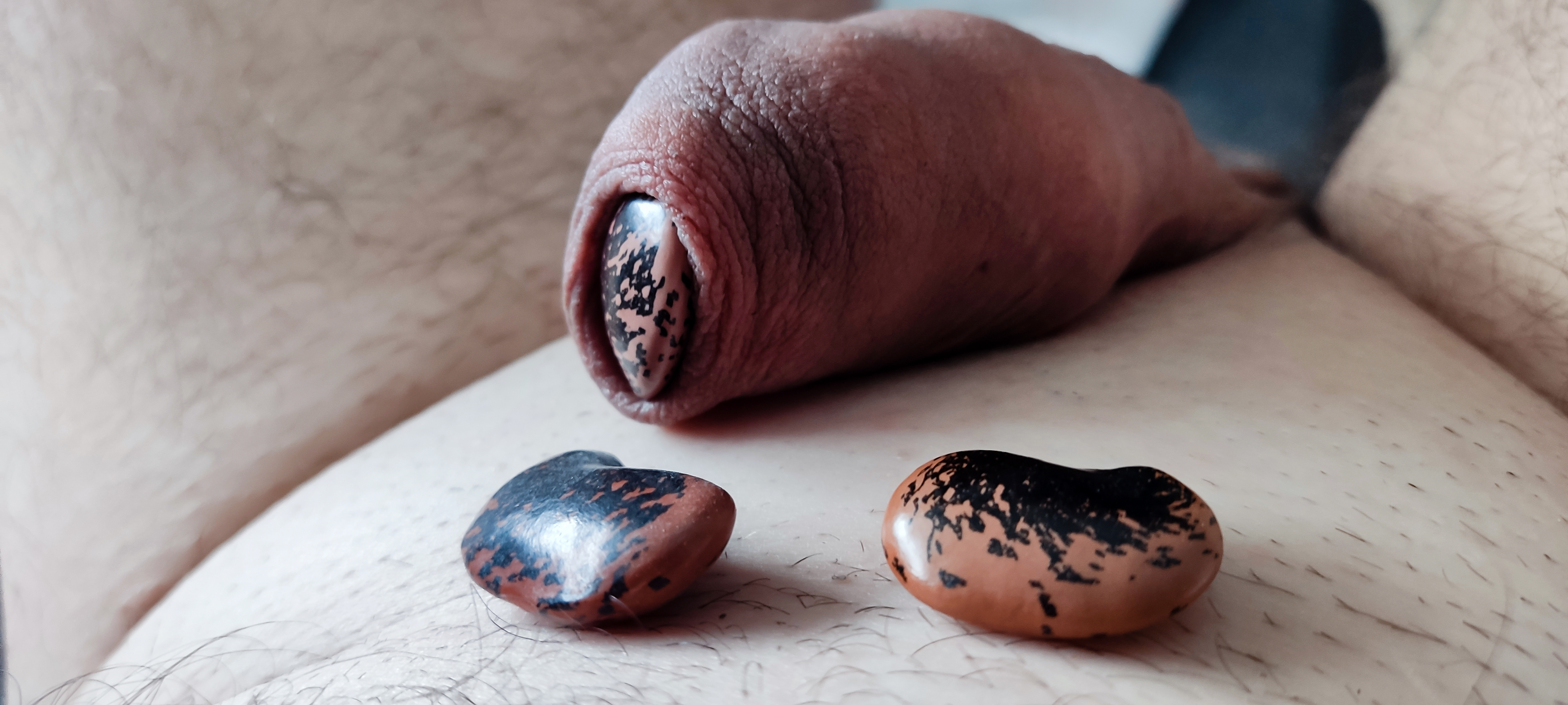 My foreskin play - bean