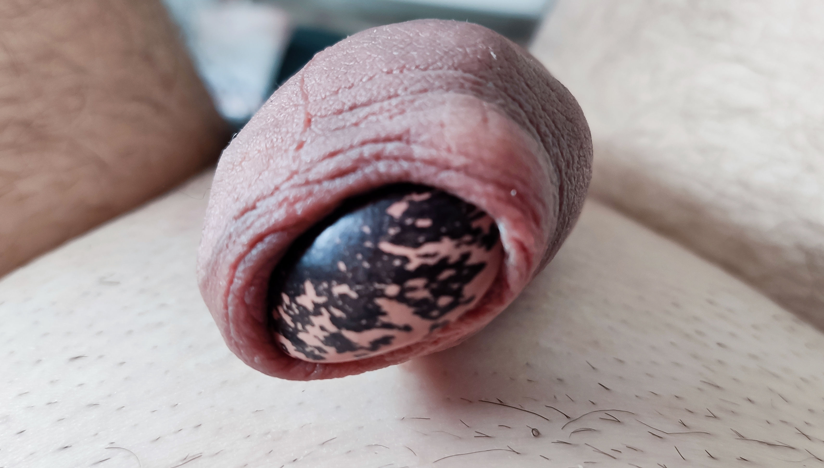 My foreskin play - bean