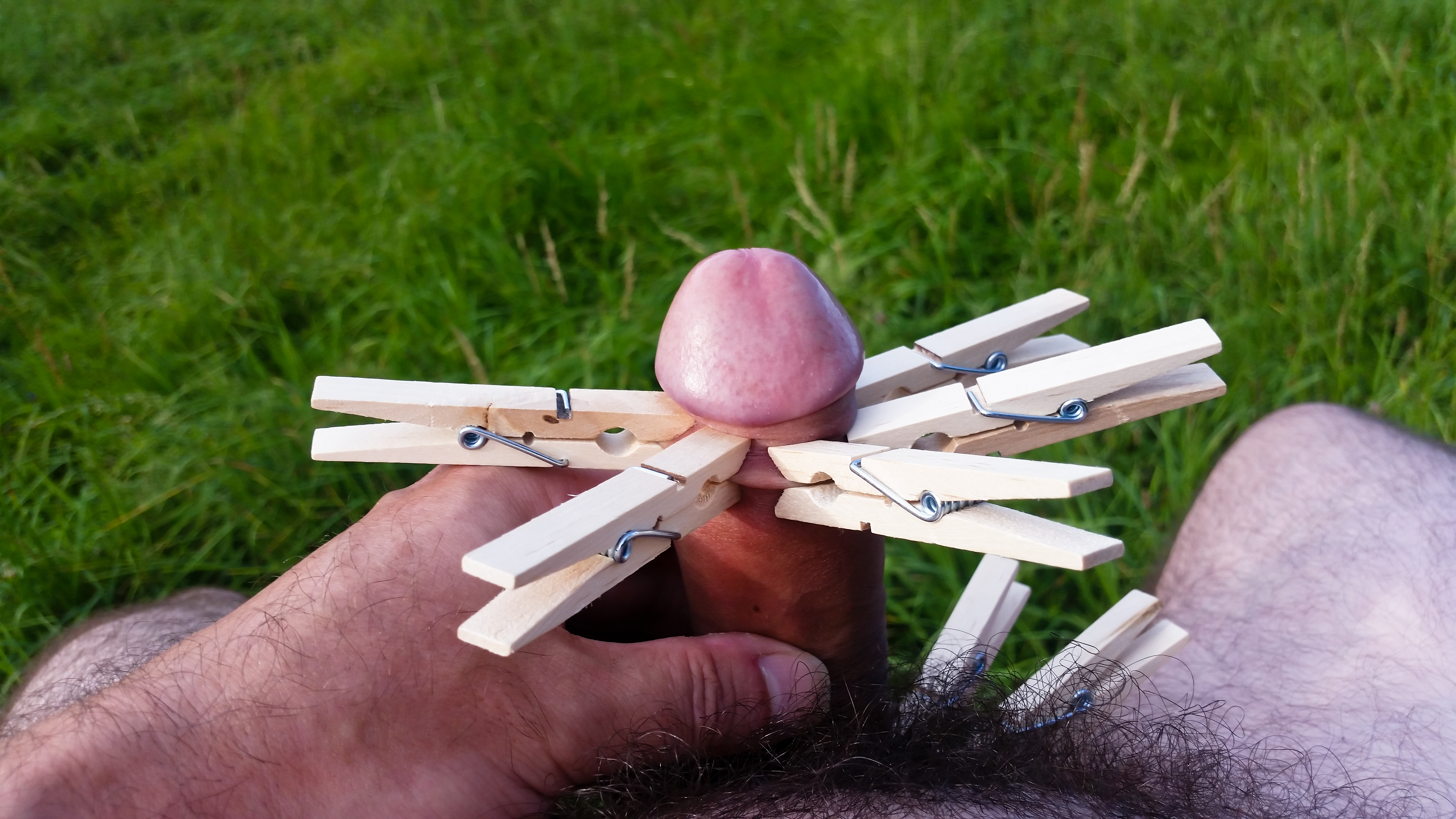 My foreskin with clothes pins